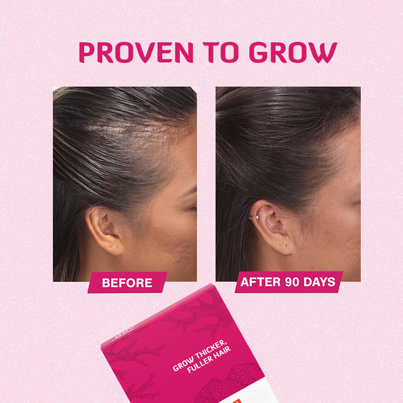Comprimidos para el crecimiento del cabello 120mcg Biotina Producto para el crecimiento del cabello