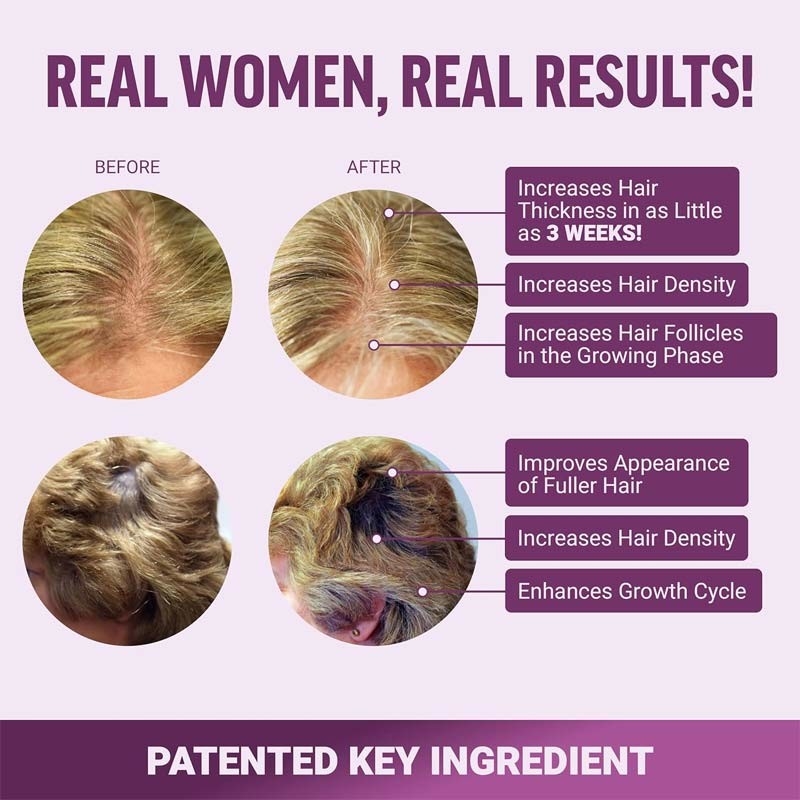 Acelerador de crecimiento del cabello masticación suave gomas para el crecimiento del cabello gomas para la fuerza del cabello