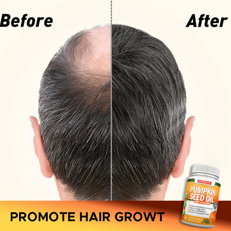Aceite de semilla de calabaza de fábrica Softgels cabello salud de las articulaciones de la próstata Omega-3 Suplemento de ácidos grasos esenciales