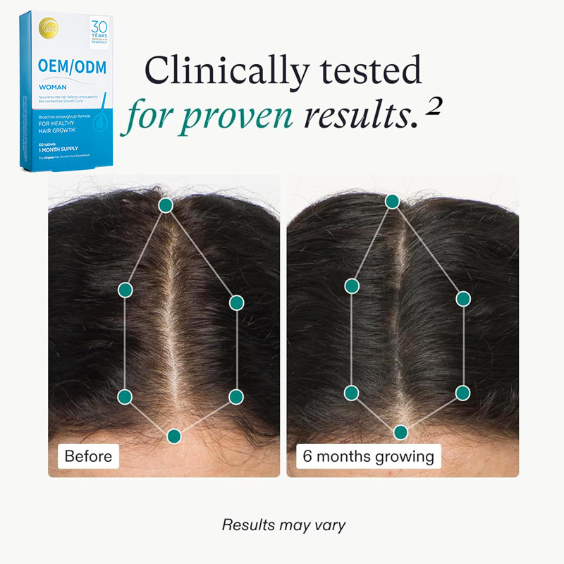 OEM Crecimiento del cabello Suplemento alimenticio de crecimiento del cabello pastillas para un fuerte crecimiento natural del cabello