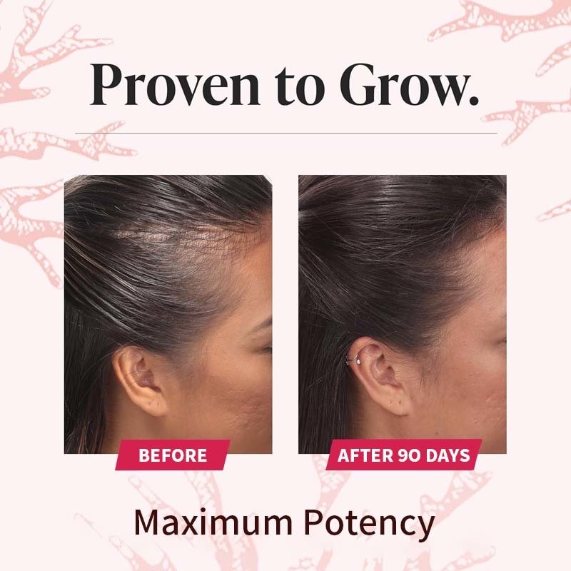 Factory in Stock Private Label Hair Growth Tablets Containing Vitamin C and Collagen Hair Growth Dietary Hair Growth Supplement