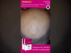 Comprimidos para el crecimiento del cabello rojo