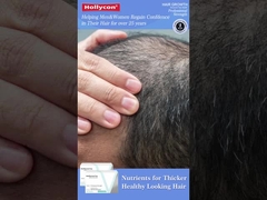 Crecimiento del pelo